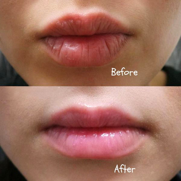 Giúp giảm khô, nứt nẻ môi và dưỡng môi hồng tự nhiên